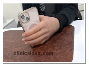 پروتز دست سیلیکونی