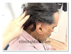 ساخت پروتز گوش و گوش سیلیکونی