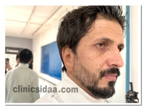 ساخت پروتز گوش و گوش سیلیکونی