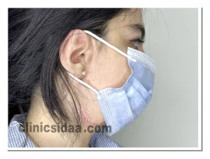 ساخت پروتز گوش و گوش سیلیکونی