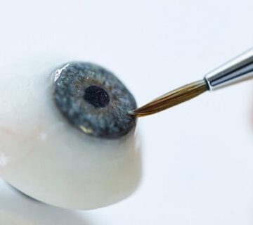 پروتز چشم چیست؟