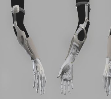 پروتز اعضای فوقانی