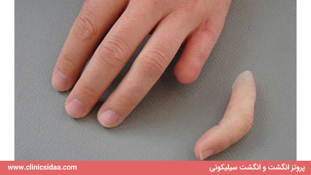 پروتز انگشت و انگشت سیلیکونی با ضمانت یکساله + کیفیت عالی + قیمت ارزان 3 پروتز انگشت و انگشت سیلیکونی با ضمانت یکساله + کیفیت عالی + قیمت ارزان
