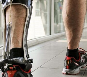 ارتوپدی فنی یکی از زیرمجموعه های رشته های پزشکی و توانبخشی است. در این زمینه افراد مهارت های لازم برای ساخت ارتز و پروتز را می آموزند. علاوه بر این، این متخصصان نحوه استفاده از این وسایل را به بیماران آموزش می دهند.