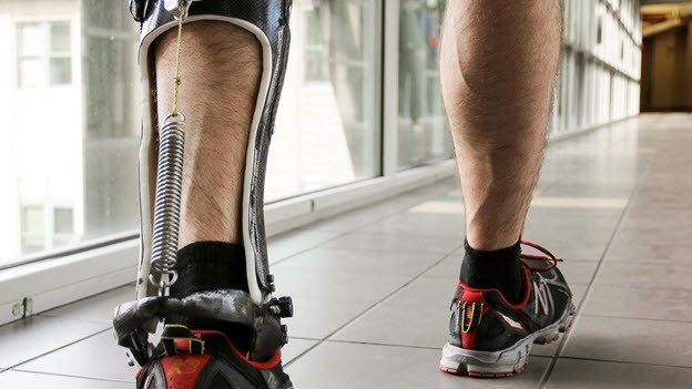 ارتوپدی فنی یکی از زیرمجموعه های رشته های پزشکی و توانبخشی است. در این زمینه افراد مهارت های لازم برای ساخت ارتز و پروتز را می آموزند. علاوه بر این، این متخصصان نحوه استفاده از این وسایل را به بیماران آموزش می دهند.