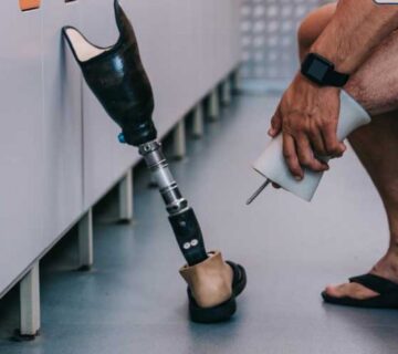 پروتزهای سیلیکونی اندام تحتانی