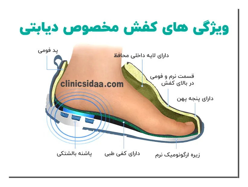 انتخاب بهترین کفش برای بیماران دیابتی