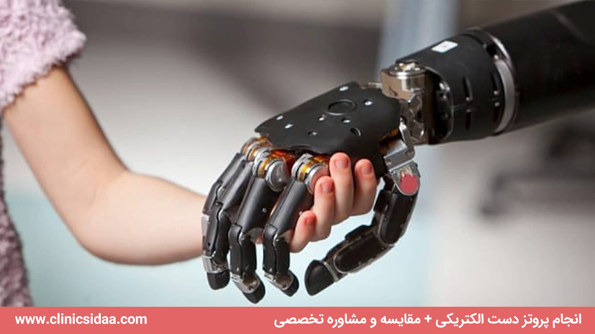 انجام پروتز دست الکتریکی + مقایسه و مشاوره تخصصی 2 انجام پروتز دست الکتریکی + مقایسه و مشاوره تخصصی