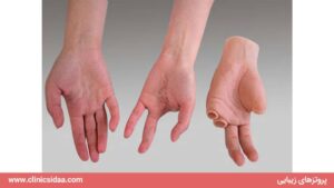 پروتزهای زیبایی | مقایسه .سفارش . مشاوره