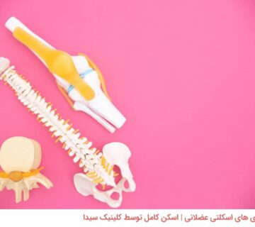 بیماری های اسکلتی عضلانی | اسکن کامل توسط کلینیک سیدا