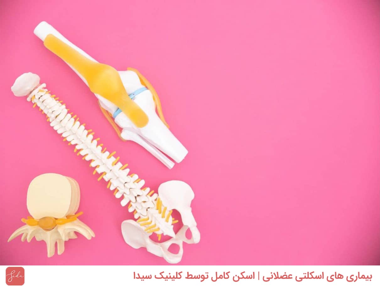 بیماری های اسکلتی عضلانی | اسکن کامل توسط کلینیک سیدا