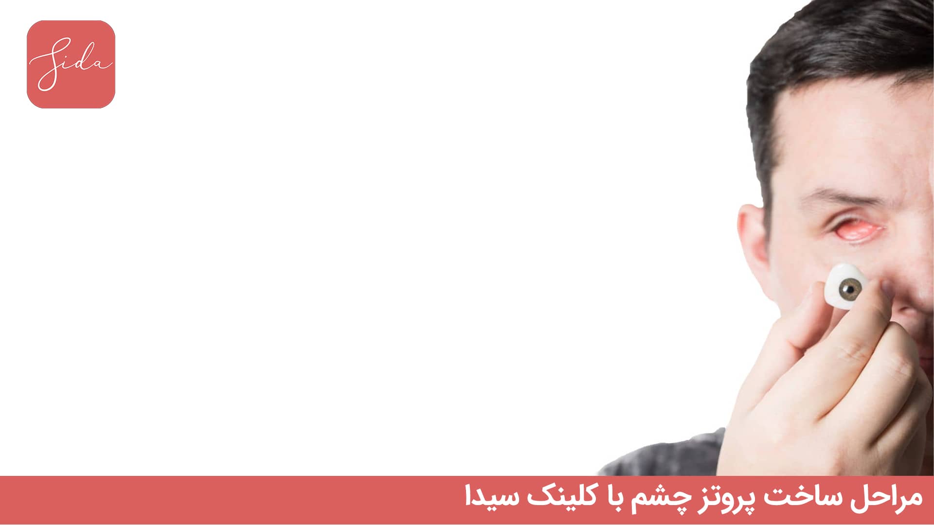 مراحل خرید و ساخت پروتز چشم با کلینک سیدا 3 مراحل خرید و ساخت پروتز چشم با کلینک سیدا