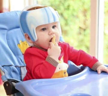 کلاه تغییر شکل سر نوزاد برای درمان صافی پشت سر کلینیک سیدا