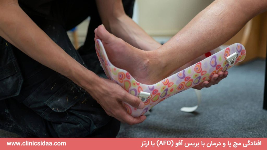افتادگی مچ پا و درمان با بریس آفو (AFO) یا ارتز