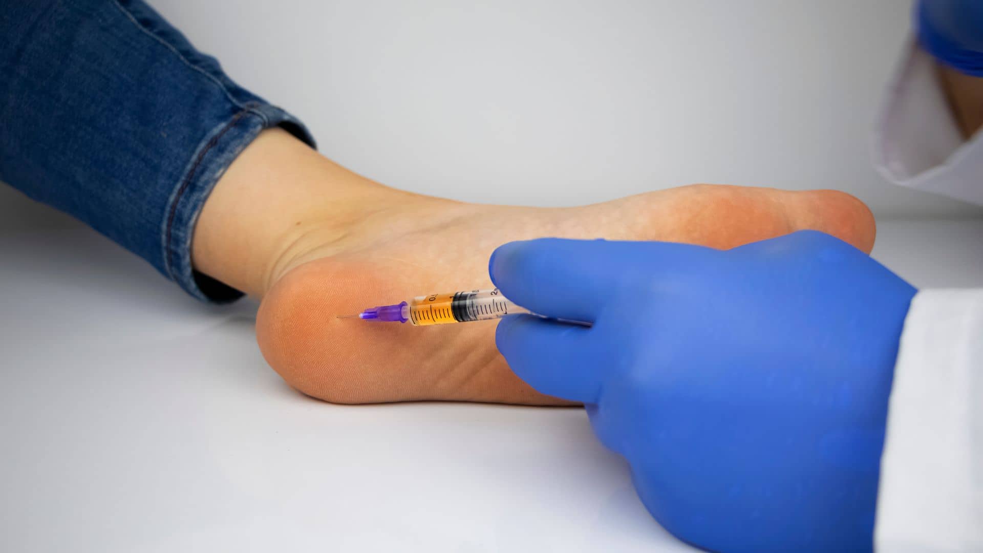 درمان فوری خار پاشنه و خار پاشنه چیست؟ علائم و نکات