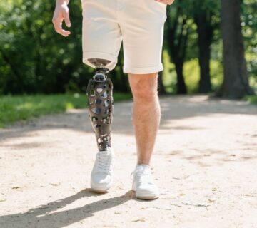 انواع مدل پروتز سیلیکونی ساق پا (پروتز ساق پا) در  2023