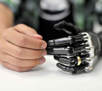 مراقبت از پروتز دست مکانیکی: راهنمای نکات مهم