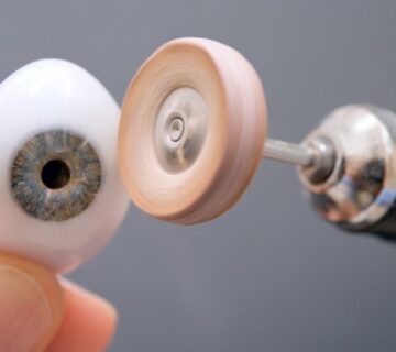 چشم مصنوعی اکریلیک در کلینیک سیدا: گزینه‌ای برای بازگرداندن دید طبیعی