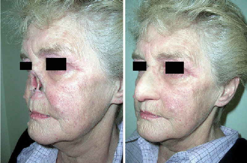 اسکن سه بعدی چیست؟