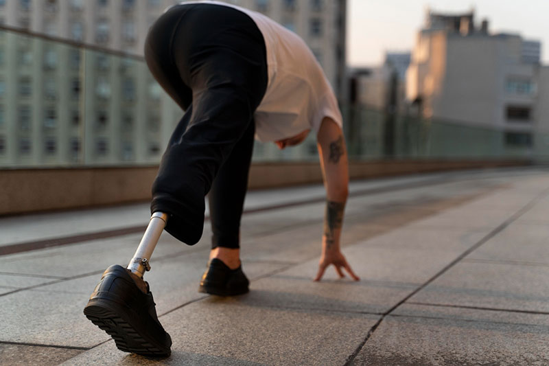 بهترین مرکز پروتز پای سیلیکونی در تهران (ساخت پای مصنوعی در تهران) 3 کلینیک سیدا، بهترین مرکز ارتوپدی پای مصنوعی در تهران!