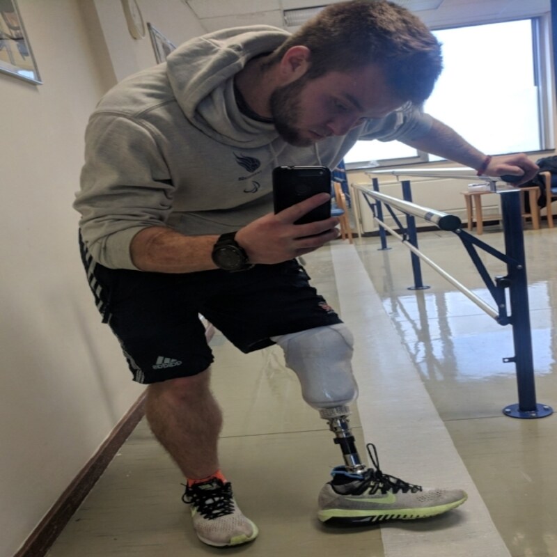 انواع پروتز پنجه پا