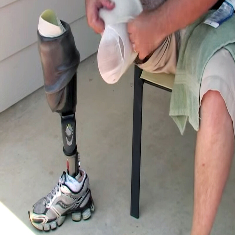 تاثیر پروتز پنجه پا بر فعالیت‌های ورزشی