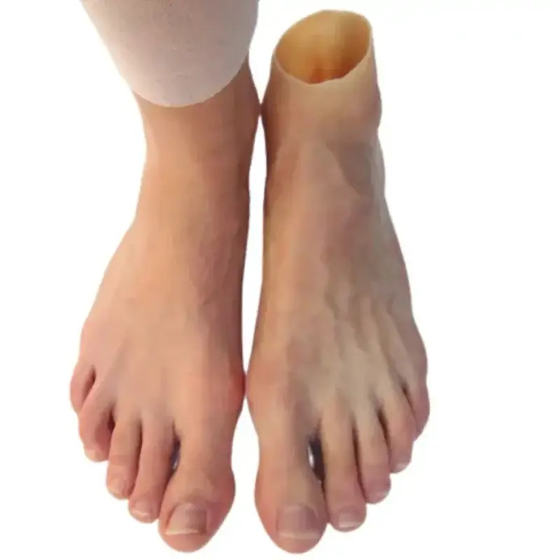 مراقبت‌ها بعد از دریافت پروتز پا