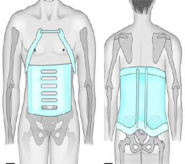 فرق بریس میلواکی با بریس شنو