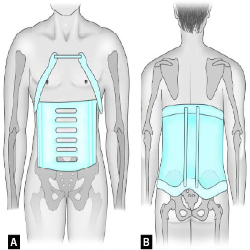 فرق بریس میلواکی با بریس شنو