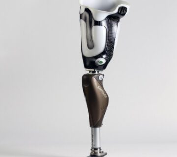 مزایا و معایب کاشت پای مصنوعی به روش ایمپلنت + نکات مهم