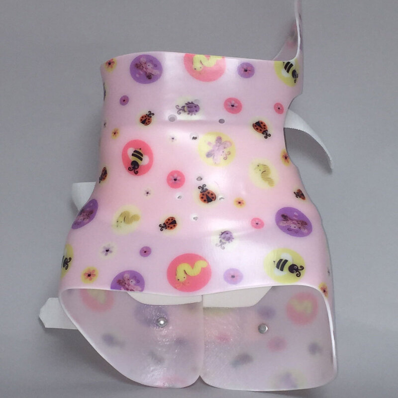 بریس شنو (Cheneau brace) چیست؟ 4 معایب استفاده از بریس شنو