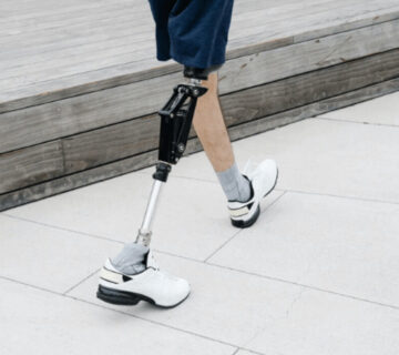 مهمترین نکات قبل و بعد از دریافت پروتز پا | مراقبت ‌ها و  زمان مناسب دریافت پروتز پا