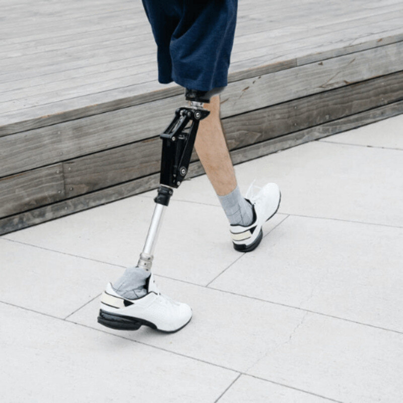 مهمترین نکات قبل و بعد از دریافت پروتز پا | مراقبت ‌ها و  زمان مناسب دریافت پروتز پا