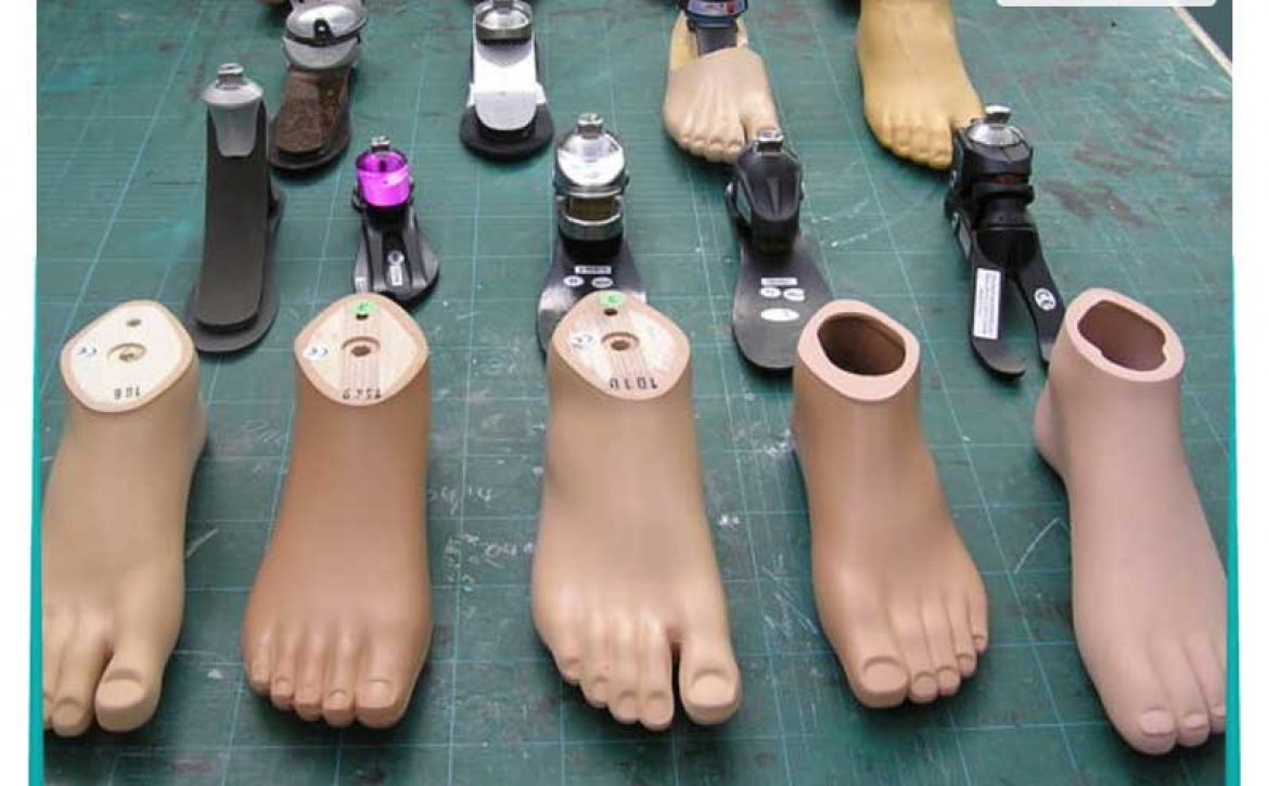پروتز پای سیلیکونی (ساخت پای مصنوعی) 1 پا مصنوعی سیلیکونی با ضمانت یکساله و اقساطی + کیفیت عالی