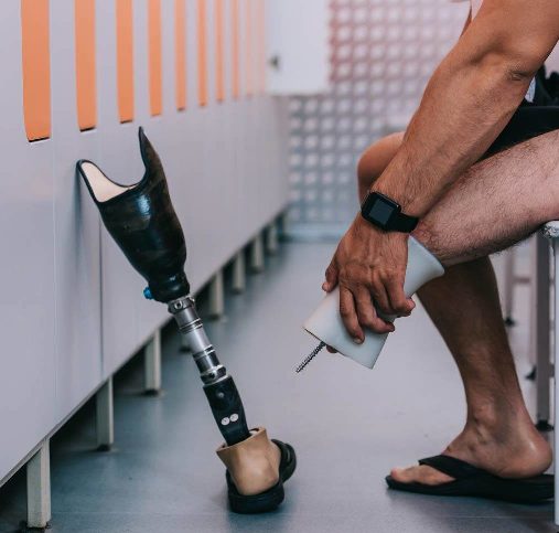 پروتز پای سیلیکونی (ساخت پای مصنوعی) 9 قیمت پروتز پا سیلیکونی