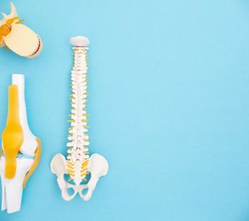 10 مورد از شایعترین بیماری‌های ارتوپدی، پیشگیری و درمان