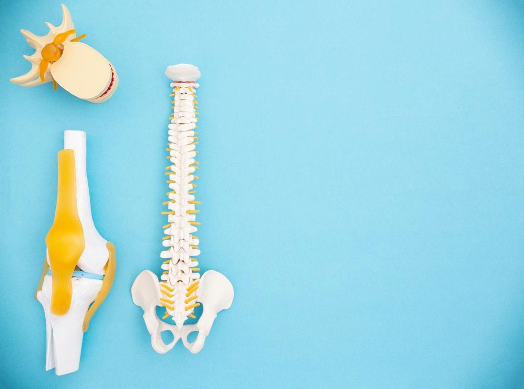 10 مورد از شایعترین بیماری‌های ارتوپدی، پیشگیری و درمان