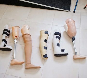 مهمترین نکات مراقبت از پای قطع شده که باید بدانید