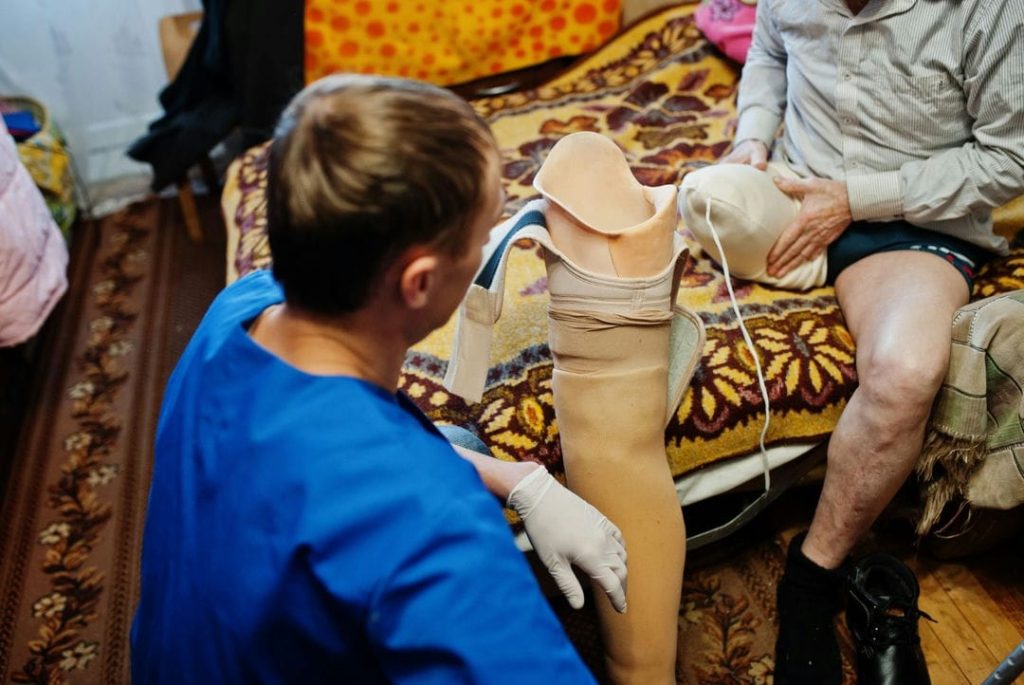 نکات مراقبتی از پای مصنوعی