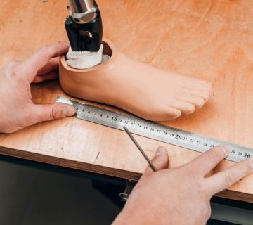 ویژگی پروتز پا دیابتی چیست؟ | ساخت پروتز پای دیابتی