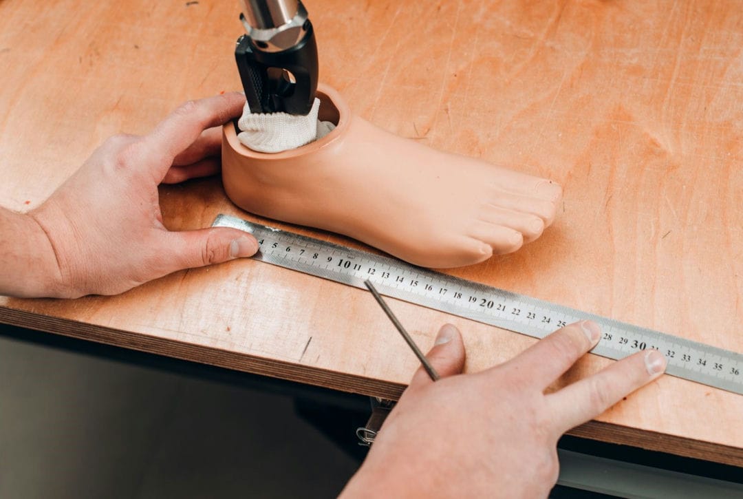 ویژگی پروتز پا دیابتی چیست؟ | ساخت پروتز پای دیابتی