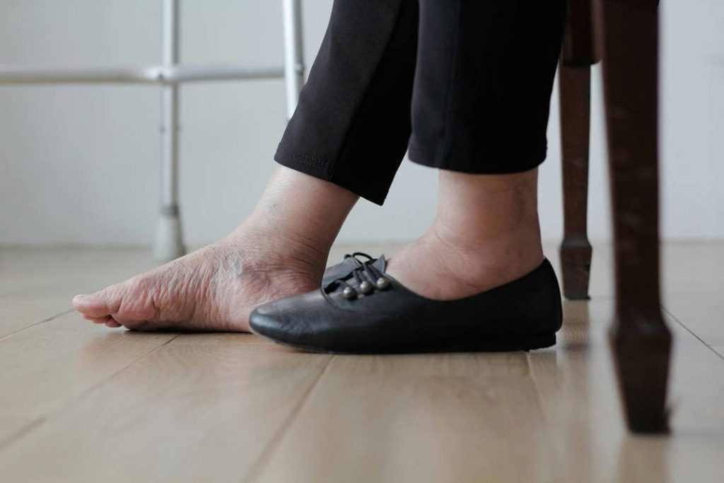 دیابت و‌زخم دیابتی