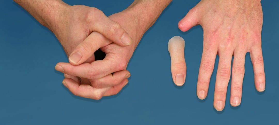 پروتز سیلیکونی چیست؟ کاربرد پروتز سیلیکونی و انواع آن 3 مزایای استفاده از پروتزهای سیلیکونی