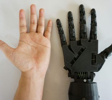 همه چیز در مورد پروتز مایوالکتریک و کاربرد‌های مهم آن