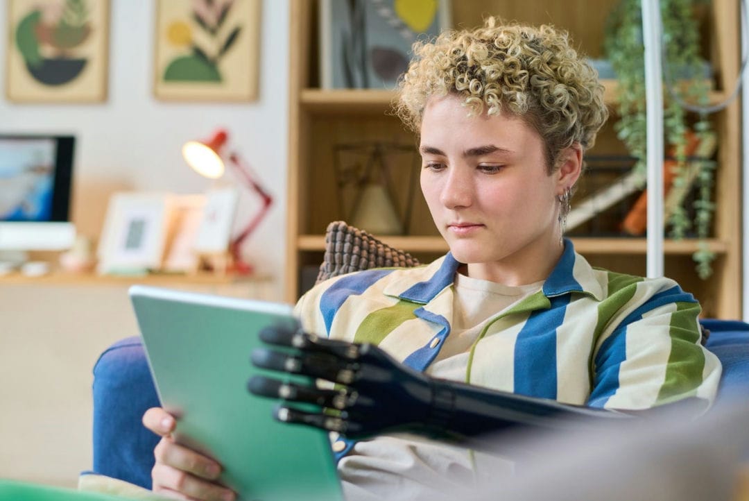 مزایای استفاده از پروتز مایوالکتریک