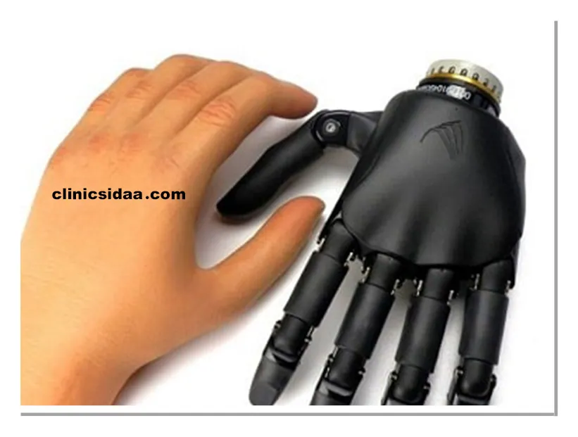 پروتزهای مچ دست الکتریکی