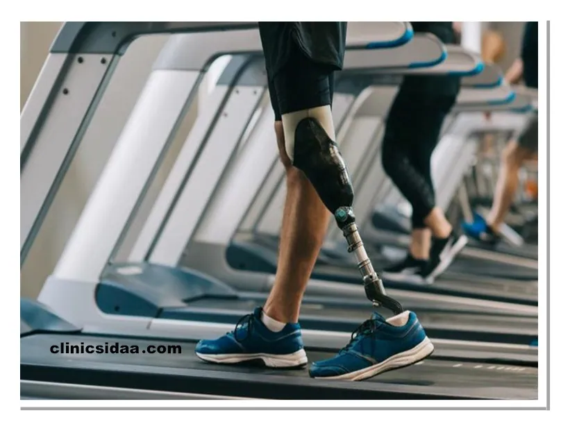 پروتز پا چیست؟ معرفی کامل، کاربردها و نکات کلیدی 7 آیا کار با پای مصنوعی سخت است