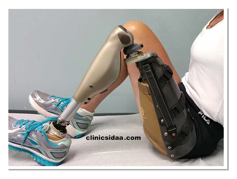 پروتز پا چیست؟ معرفی کامل، کاربردها و نکات کلیدی 2 پروتز پا چیست