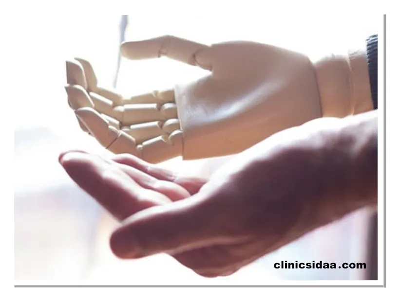 پروتز مچ دست چیست