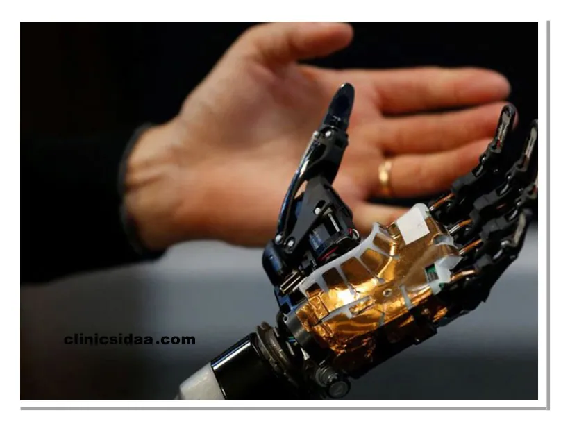  خرید پروتز مچ دست 